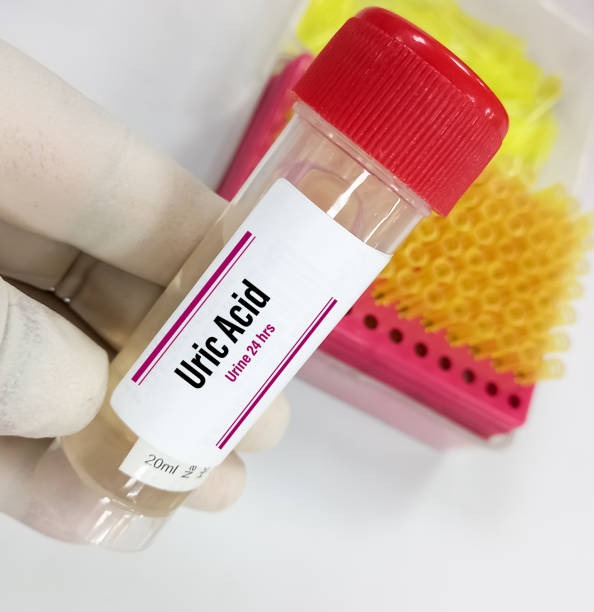 Diagnosis of Metabolic Disorders in Children